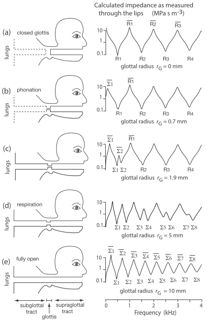 cartoon of different glottis openings and corresponding graphs of Z(f)